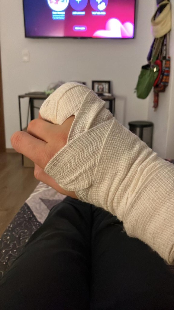 Hand bandage Hand bandage